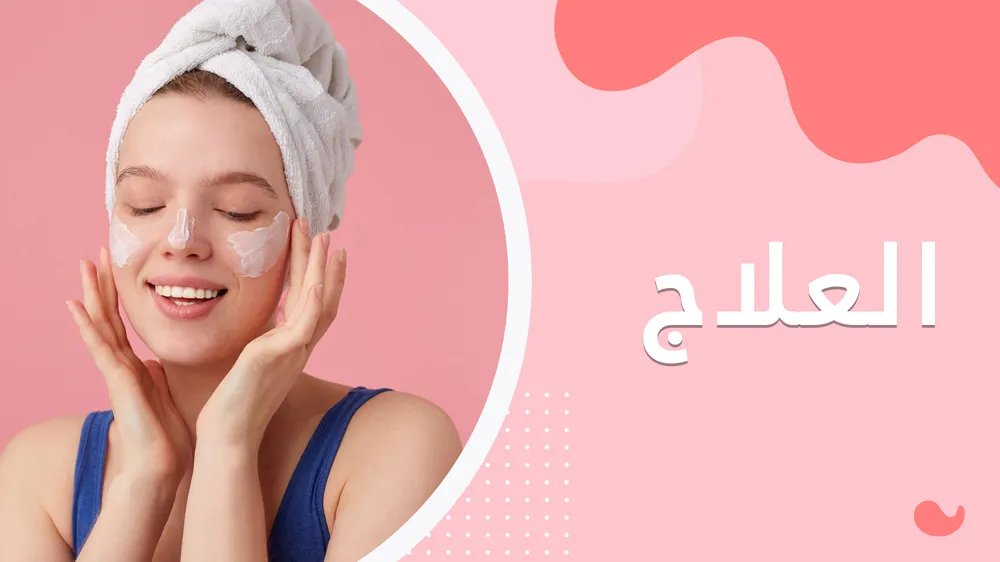 كيفية معالجة حب الشباب